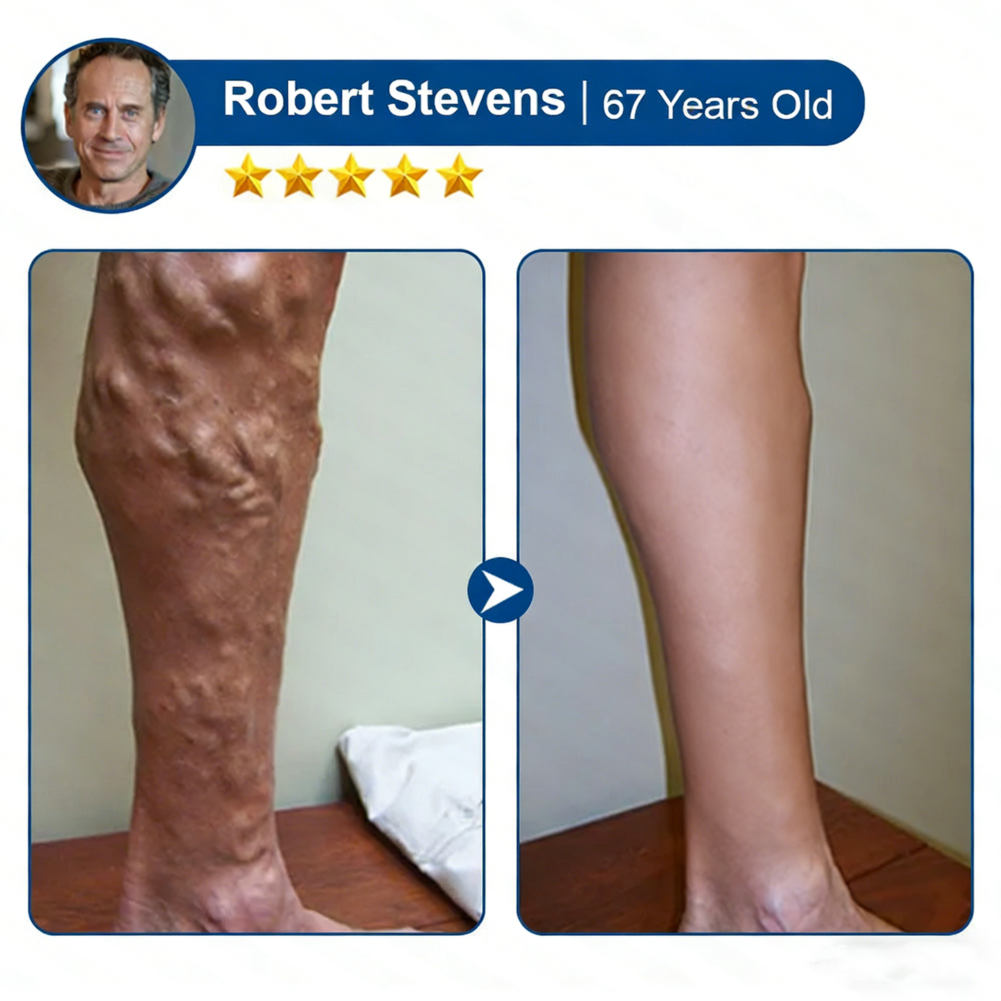 Alisanda® Skip Costly Procedures — Find Relief With One Easy Patch!