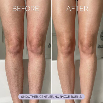 Alivmi Hair Removal Mousse