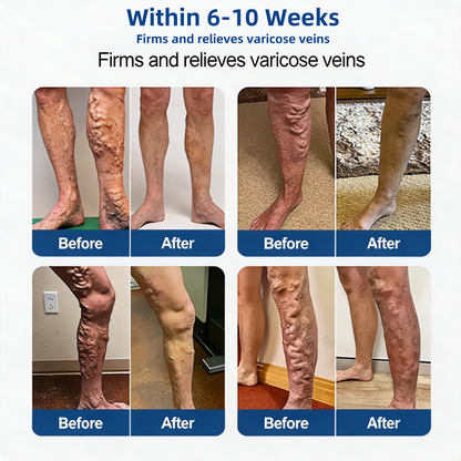 Alisanda® Skip Costly Procedures — Find Relief With One Easy Patch!