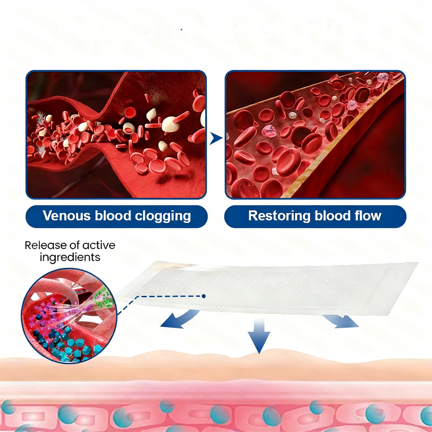 Alisanda® Skip Costly Procedures — Find Relief With One Easy Patch!